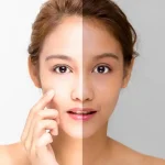 Get a Brighter Complexion with Innovative Skin Whitening Solutions